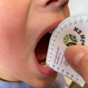 NZ MyoMasters Myoruler